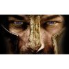 Spartacus yıldızı hayatını kaybetti 